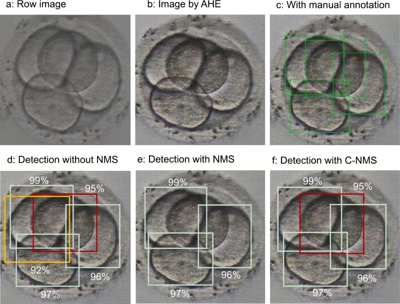 AI Embryo Assessment